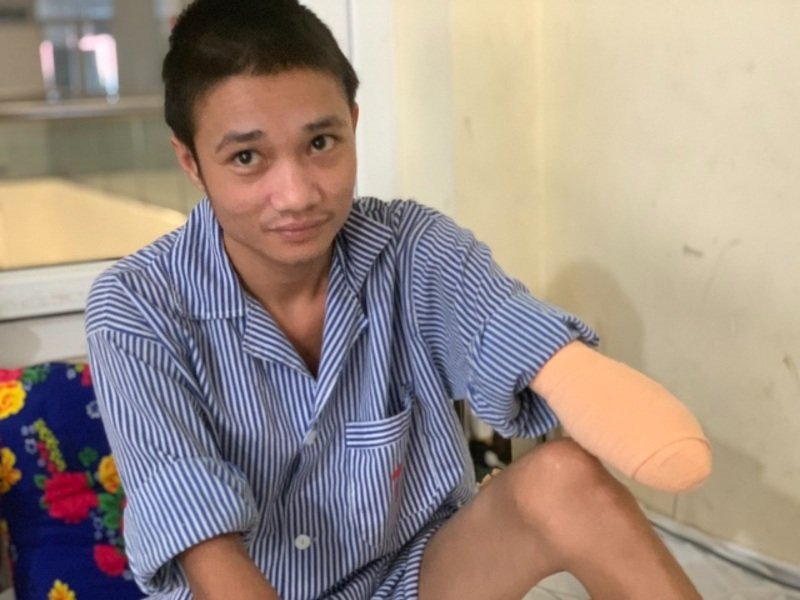 Mộng thấy mình bị cụt cả hai bàn tay