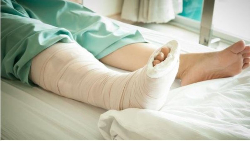 Chiêm bao thấy con chó mà mình yêu quý bị gãy chân quất ngay cặp lô 48 - 17