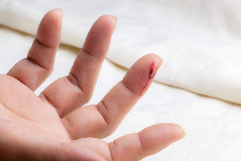 Giấc chiêm bao này mang đến sự xui xẻo, không may mắn