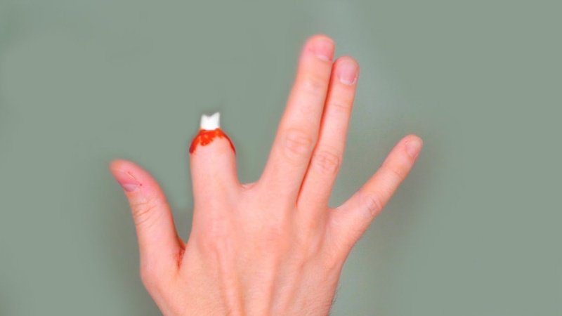 Mộng thấy người thân bị đứt tay chảy máu