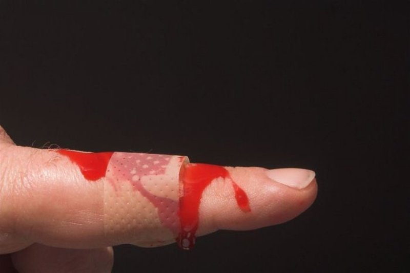 Ngủ mơ thấy mẹ bị đứt tay chảy máu chốt nhanh cặp số 67 - 64